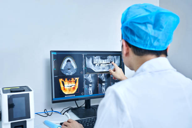 Best Emergency Root Canal Treatment in Viera West, FL