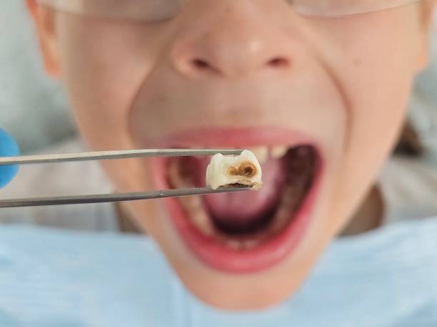 Best Pediatric Emergency Dentist in Viera West, FL