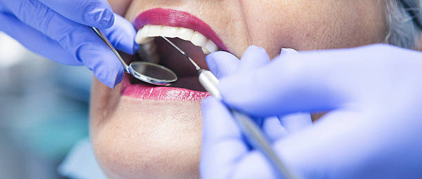 Best Emergency Dentist for Knocked-Out Tooth in Viera West, FL